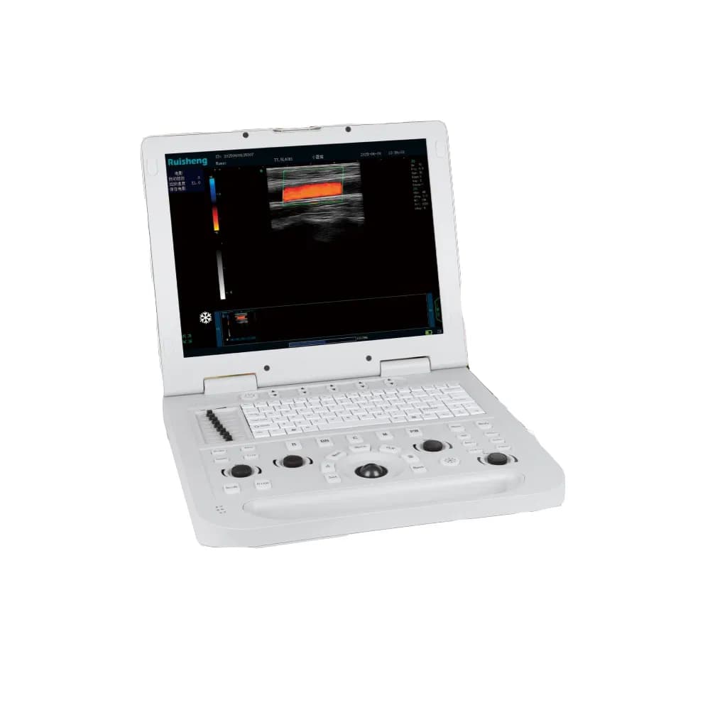 Factory Price Portable Full Digital Ultrasound Scanner System Application Laptop Color Doppler Ultrasound Machine