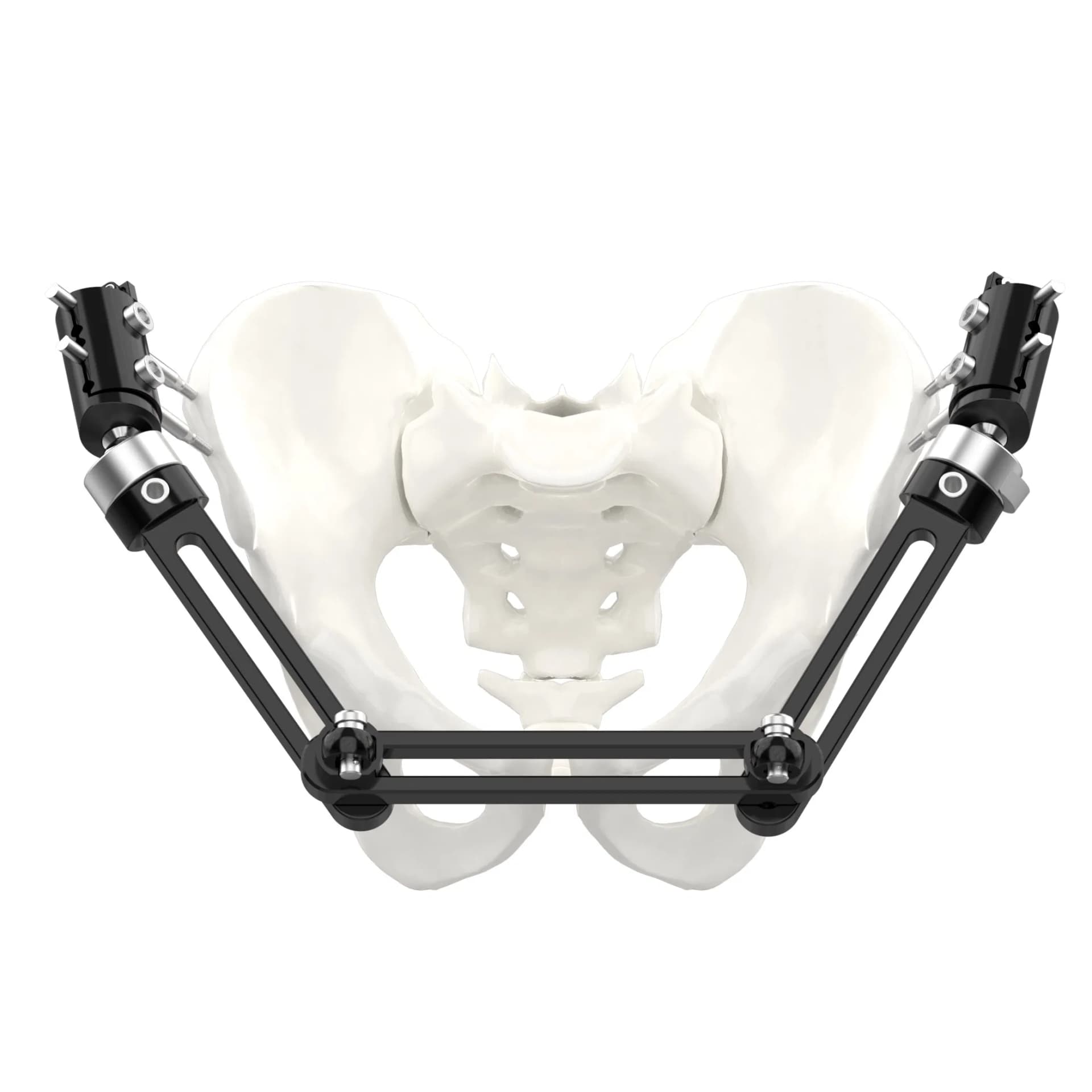 Canwell Large External Fixation System Pelvic Frame for Modular Construction Pelvic Ring Fractures Arthrodesis Osteotomies
