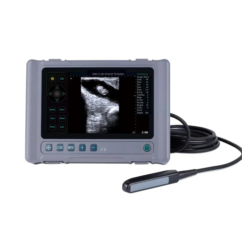 Medical Equipment Veterinary Digital Handheld Ultrasound Machine Ultrasound Scanner Handheld Ultrasound Probe