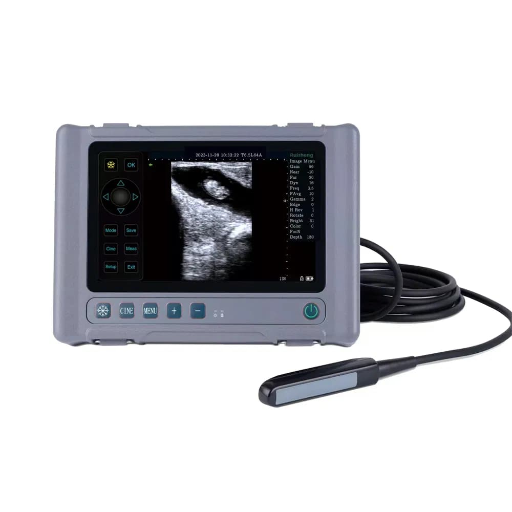 Best Selling Portable Probe Ultrasound Scanner Hospital Equipment Scanner Handheld Veterinary Ultrasound