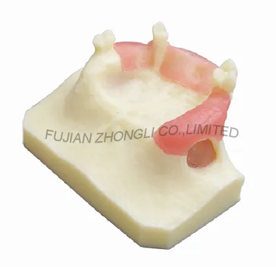 Cheap Resin Sinus Lift for Implant Lowest Price