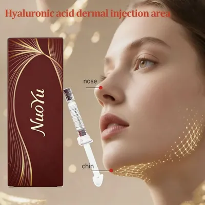 Hyaluronic Acid Fillers—Dermal Fillers for Chin and Nasal Contouring.