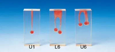 High Quality Resin Root Canal Filling S6