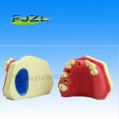 Dental Implant for Education
