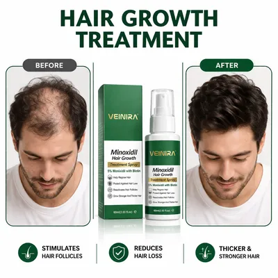 Minoxidil Hair Growth Anti Hair Lose Serum Spray Thickening Treatment Best Biotin Vitamins Hair Growth Product