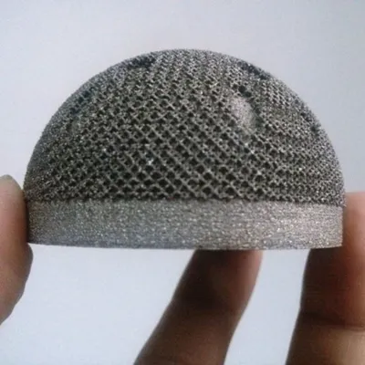 Hot Sales 3D Printing Customized Digital Standardization Precision Orthopaedic Medical Implants