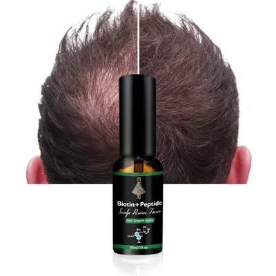 Natural Organic Vegan Hair Growth Serum Treatment Scalp Revive Toner Anti Loss Biotin Peptide Scalp Care Spray