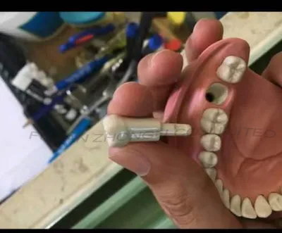 Cheap Replacement Teeth for Kavo Typodont