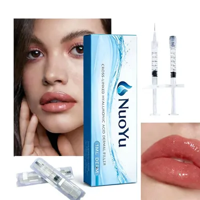 2ml Hyaluronic Acid Filler for Plump, Luscious Lips; Lip Filler.