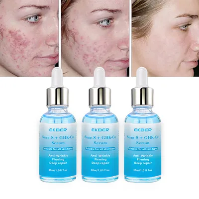 Skin Care Face Serum Skin Brightening Moisturizing Snap 8 Ghk-Cu Serum