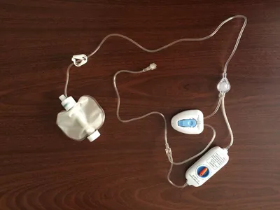 Disposable Elastomerica Soft Infusion Pump-PCA& Multiple Rates