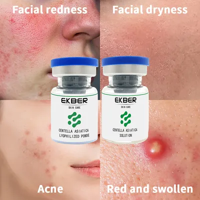Anti-Puffiness Dark Circles Serum Centella Asiatica Freeze Dried Powder Moisturizing Firming Essence