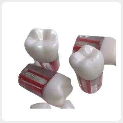 Cheap Endodontic Teeth Root Canal Treatment S12