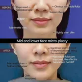 Effect