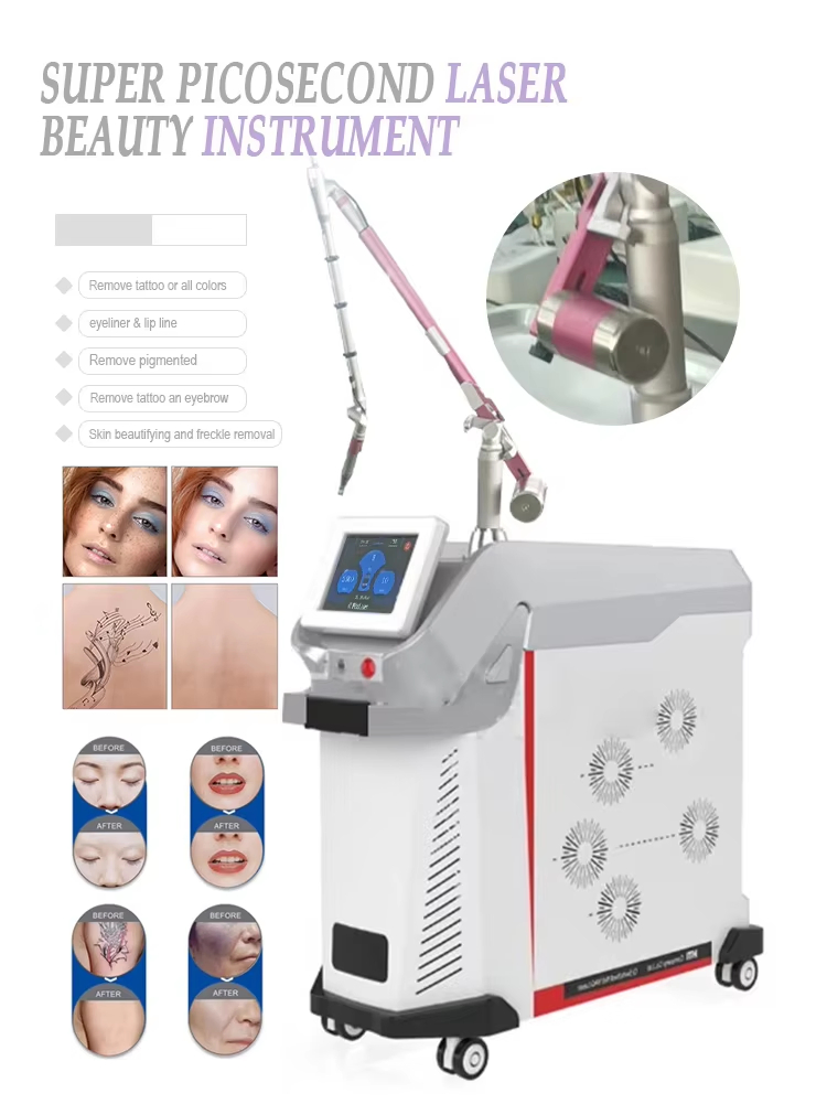 Q Switched Picosecond Laser Tattoo Removal Beauty Equipment