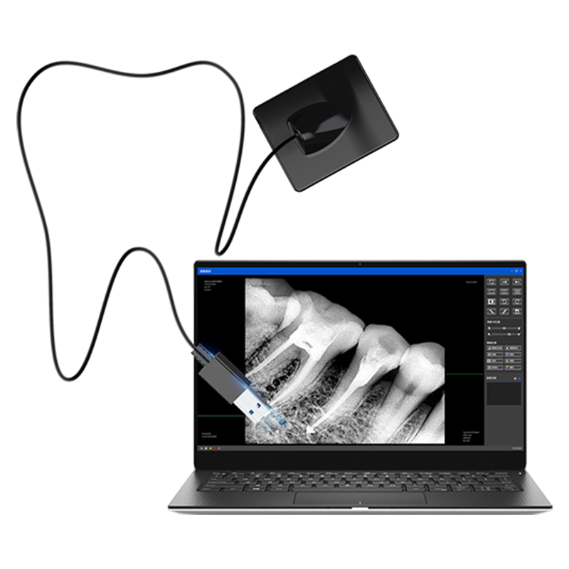 LK-C69 Xpect Vision Digital Dental Imaging Intra Oral RVG X-Ray Sensor with Holder